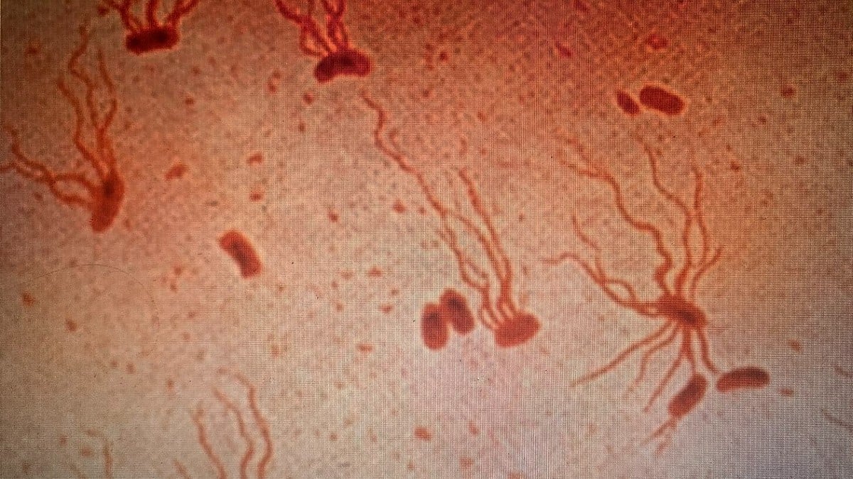Registent Drug-resistant Salmonella is a major future threat. Can hurt China