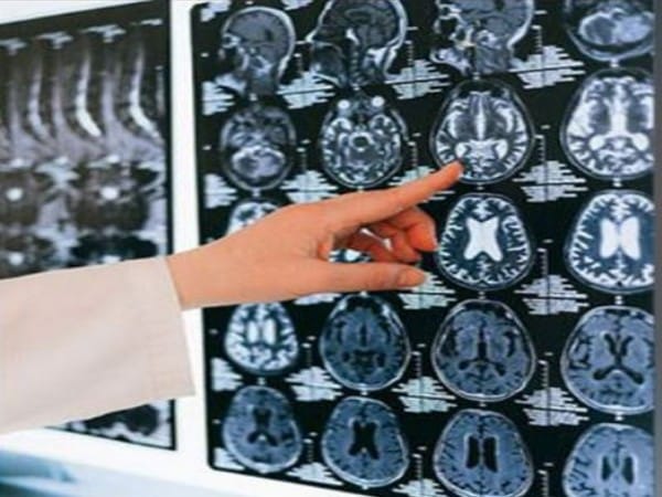 Researchers give more insight into how brain creates conscious perception