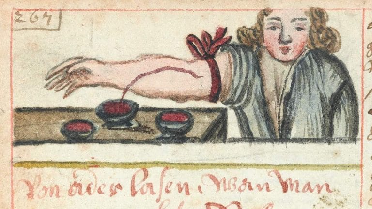 Modern medicine has its scientific roots in the Middle Ages – bloodletting to vulture brain remedies