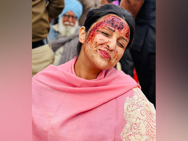 Parineeti Chopra drops BTS pics from 'Amar Singh Chamkila' sets