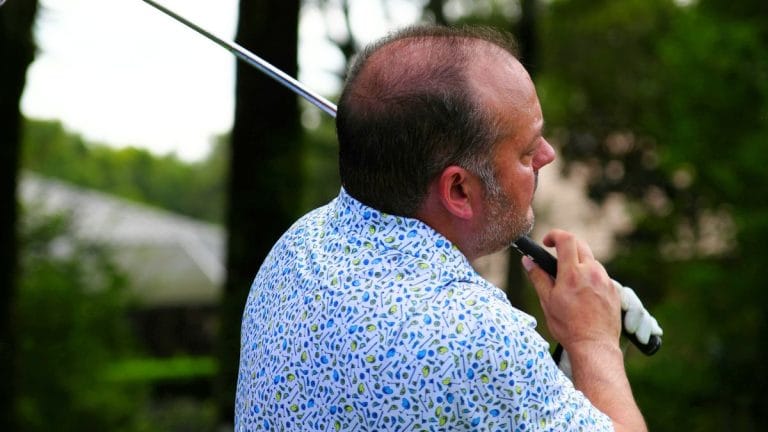 What is clascoterone? Promising new drug that targets root cause of pattern baldness