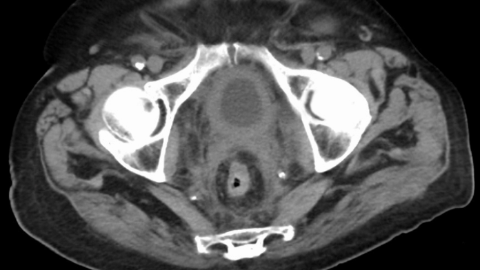 Representational image | Commons