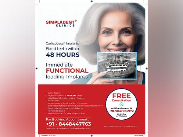 Immediate Loading Dental Implants: Simpladent Clinics Revolutionize Oral Health with 48-Hour Full Mouth Rehabilitation