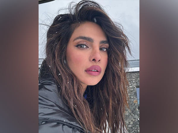 Priyanka Chopra shares glimpse of injury from set of 'The Bluff'