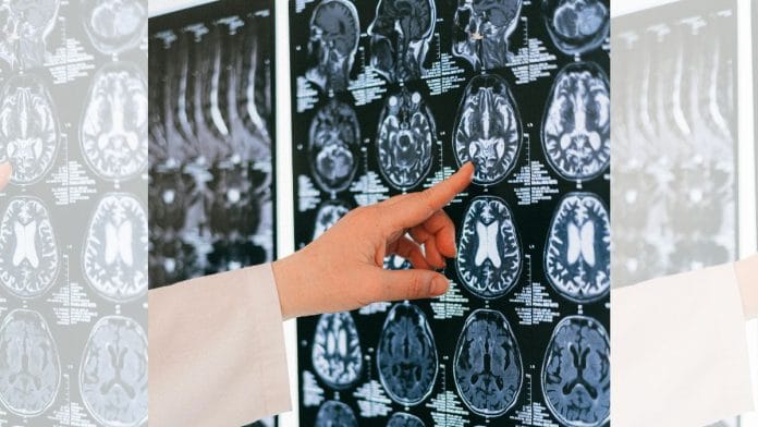 Representational image | Pexels