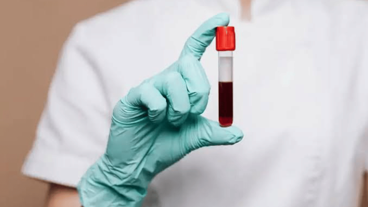 Scientists are looking for the perfect anti-ageing blood cocktail. Billionaires can’t wait