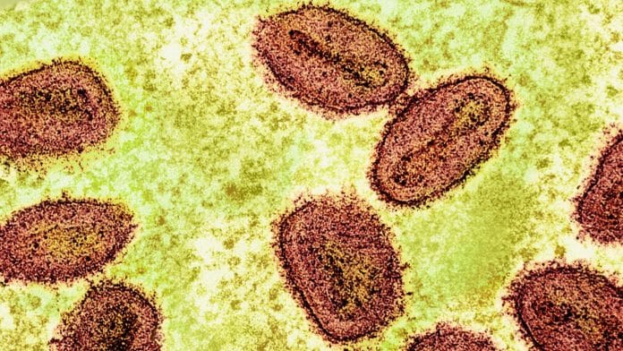 Representational Image of mpox | Flickr