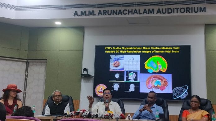IIT Madras Tuesday became the world’s first research organisation to develop the most detailed, three-dimensional high-resolution images of the foetal brain | Aneesa PA | ThePrint