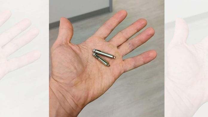 A dual chamber leadless pacemaker | Credit: UC Davis Health