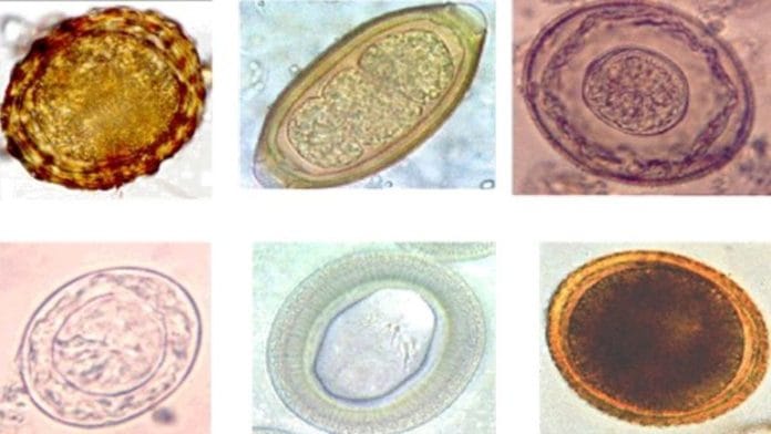 Representational image of helminths | Wikimedia Commons