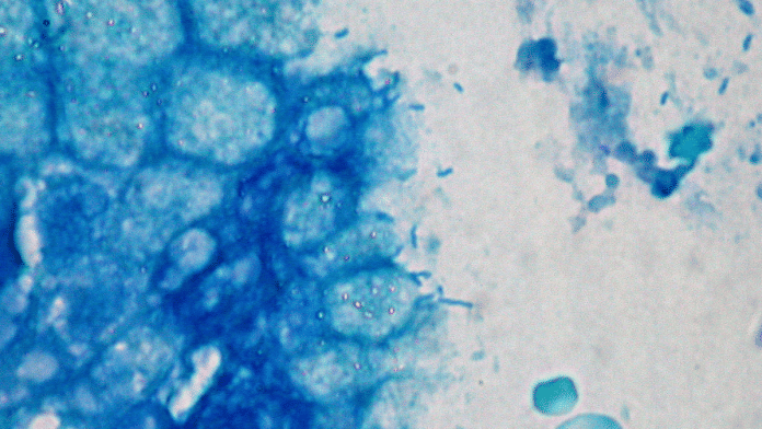 File photo of H pyori bacteria | Image via Commons