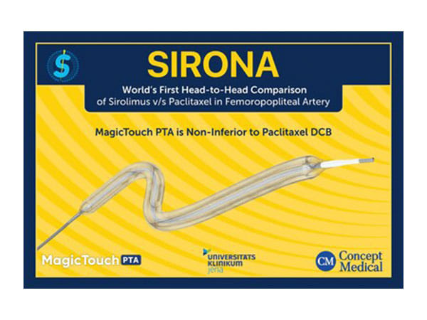 Concept Medical Announces Successful SIRONA Trial Results, Demonstrating Sirolimus-Coated Balloon as a Promising Alternative for PAD Treatment