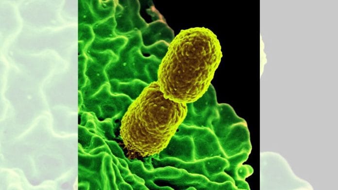 Klebsiella pneumoniae, a superbug | Wikimedia Commons
