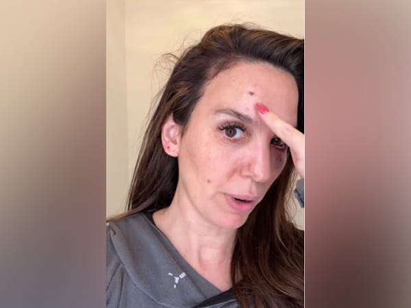Christy Carlson Romano shares she was 
