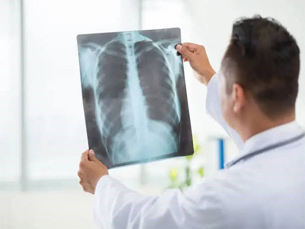 Signs You May Require an X-ray