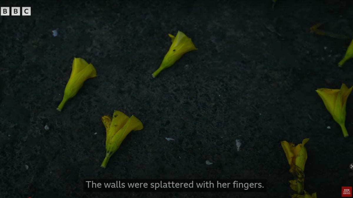 A child victim of a crude bomb explosion in West Bengal, India.