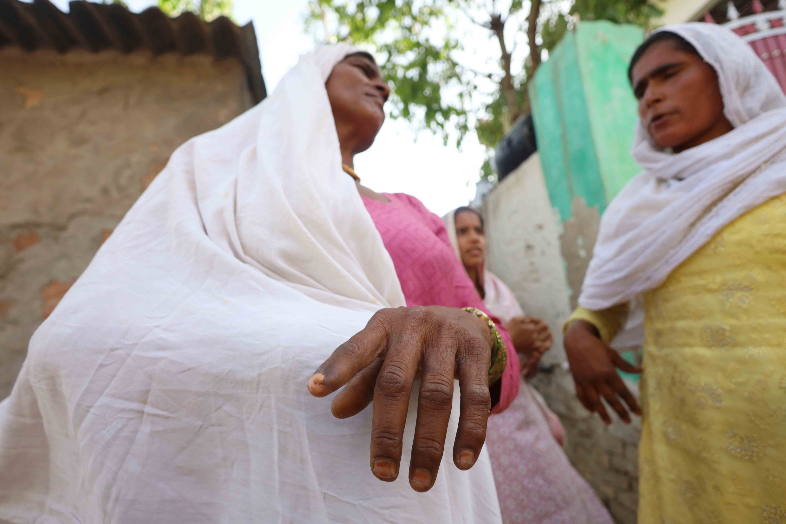 Ameena claims her finger got disfigured due to working in close proximity to a waste burning unit