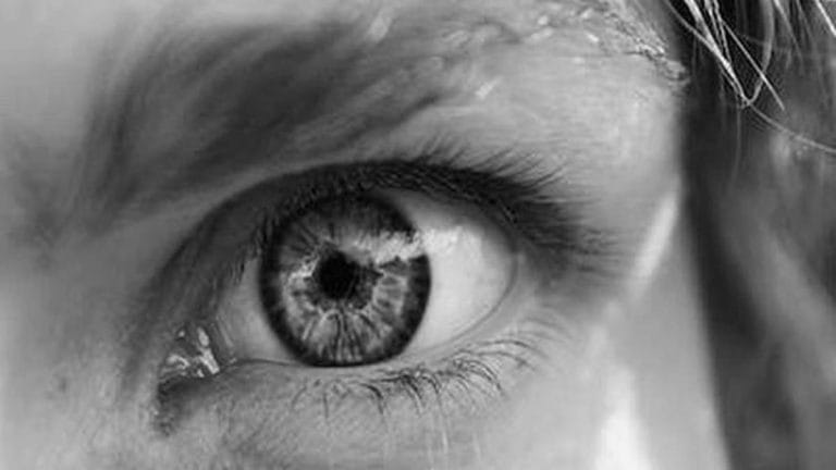 Itchy, crusty, and swollen eyelids can signal more than just tired eyes