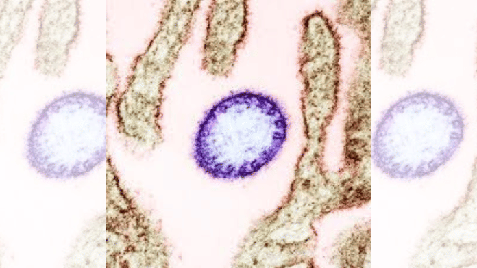 Nipah virus from an infected VERO cell | Commons