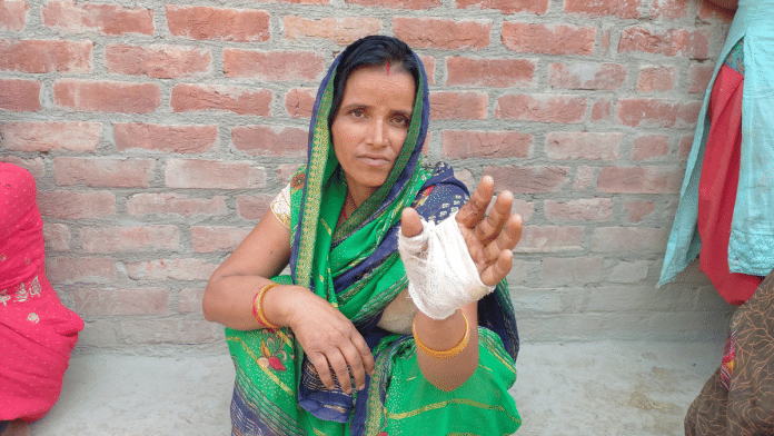 Seema Devi, a resident of UP's Vibharapur village, says police personnel did not spare even women when a clash broke out on 5 April | Prashant Srivastava | ThePrint
