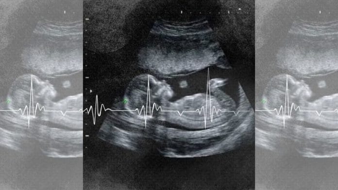 Illustration by Manisha Yadav | ThePrint