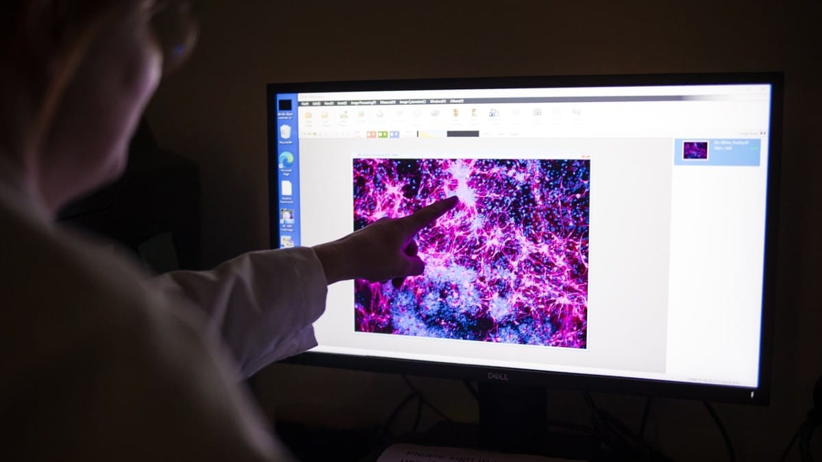 Researchers, clinicians began collaborating on creating customized gene editing therapies for individuals in 2023 | Courtesy: Children’s Hospital of Philadelphia