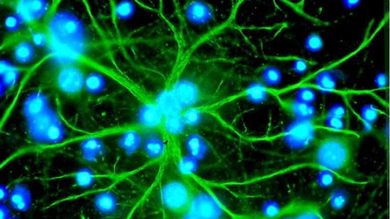 Astrocytes are no wallflowers. 3 new studies show they’re the real ‘puppet masters of brain’