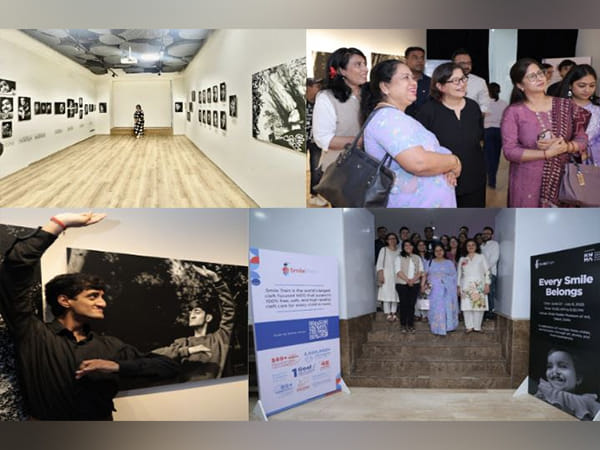 The Country's Largest Cleft-focused NGO, Smile Train India, Presents 