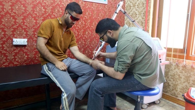 AK-47s, Quran verses, lovers’ names —the tattoos Kashmiris are rushing to remove