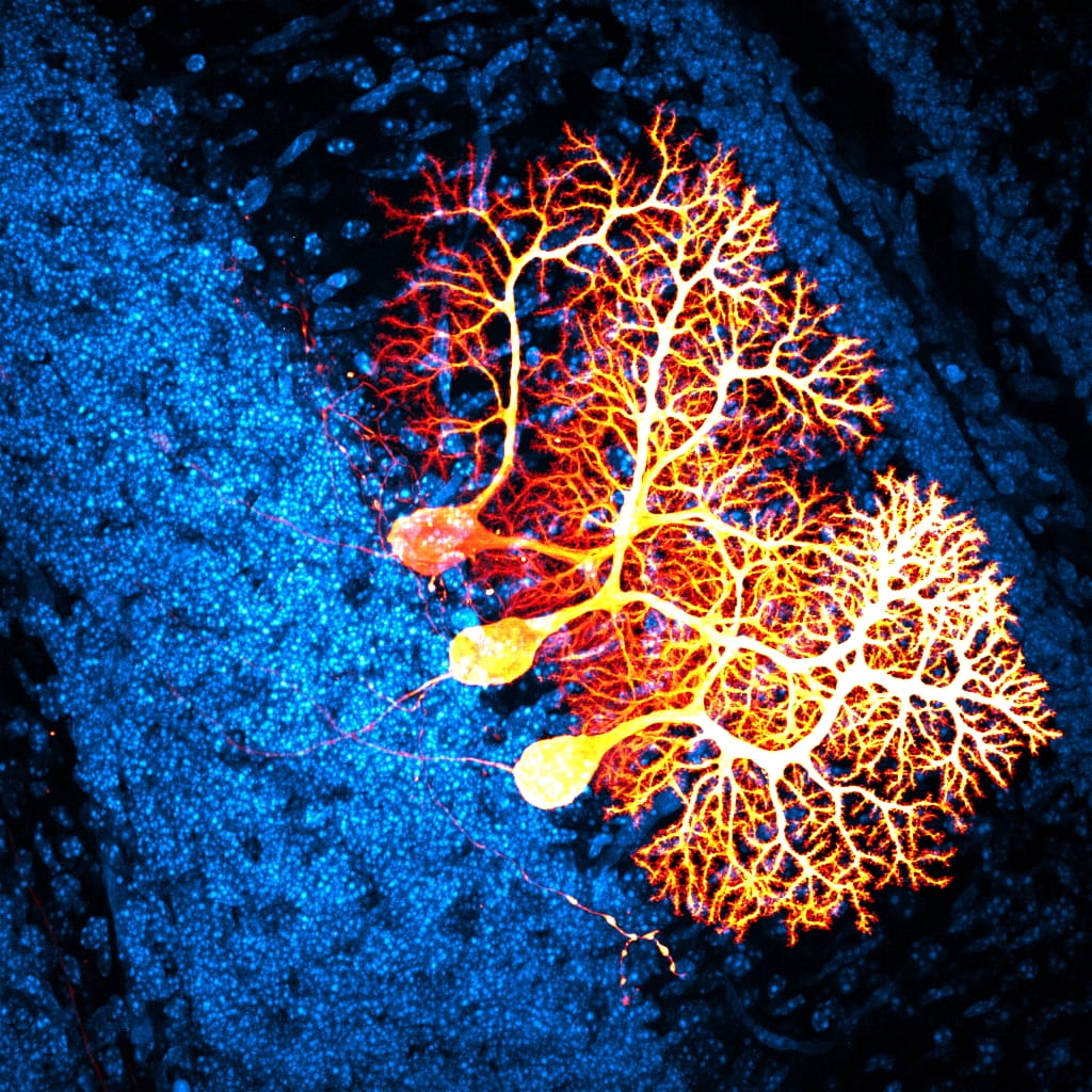 Neurons are the brain’s messengers, and one clue to what makes us human | Image courtesy ITSA