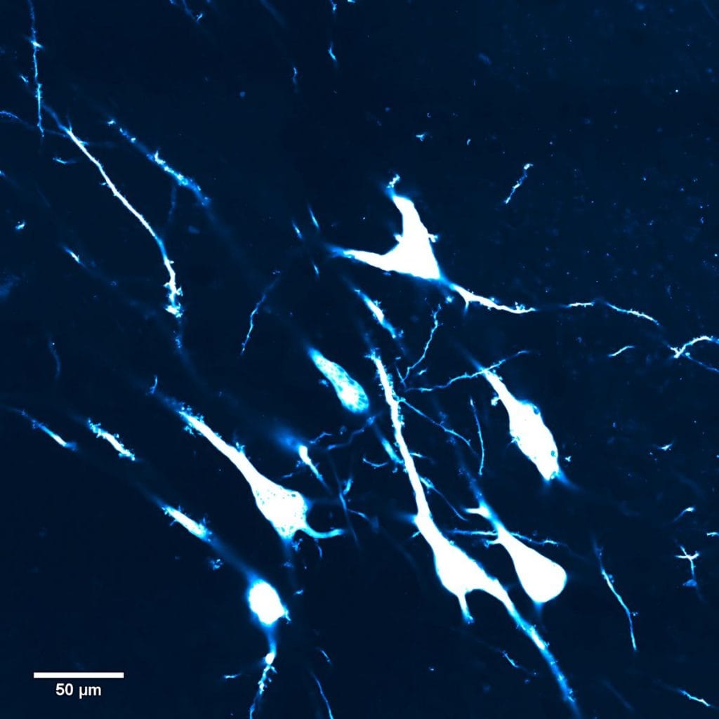 Neurons in a human brain