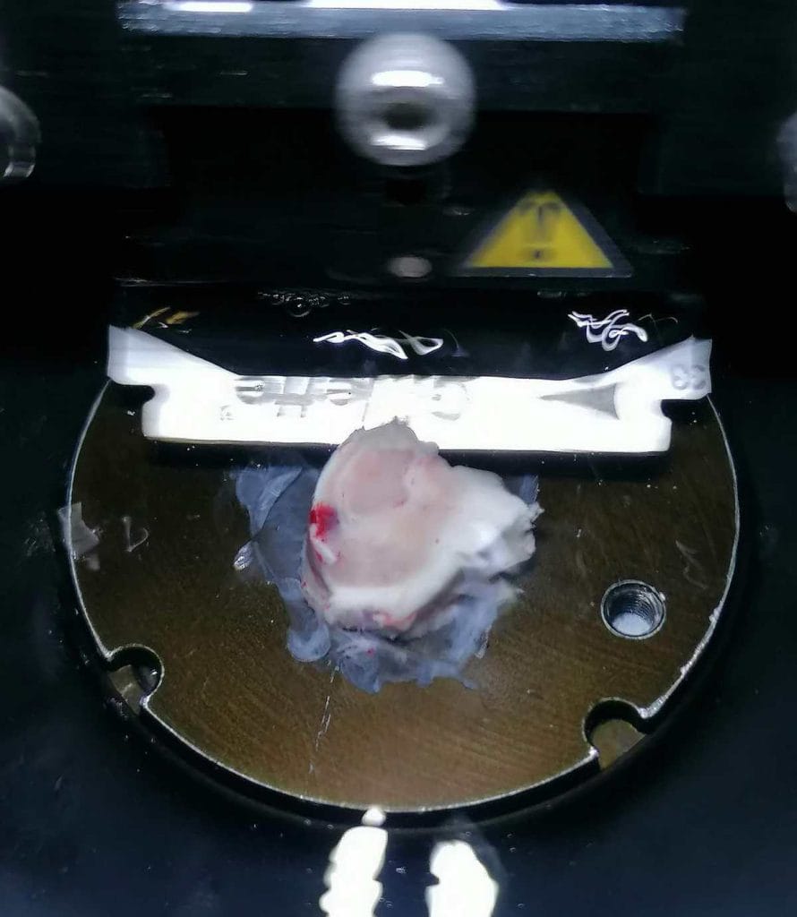 Human brain tissue being sliced. The samples came from epilepsy patients who had surgery and consented to research use | Image courtesy ITSA