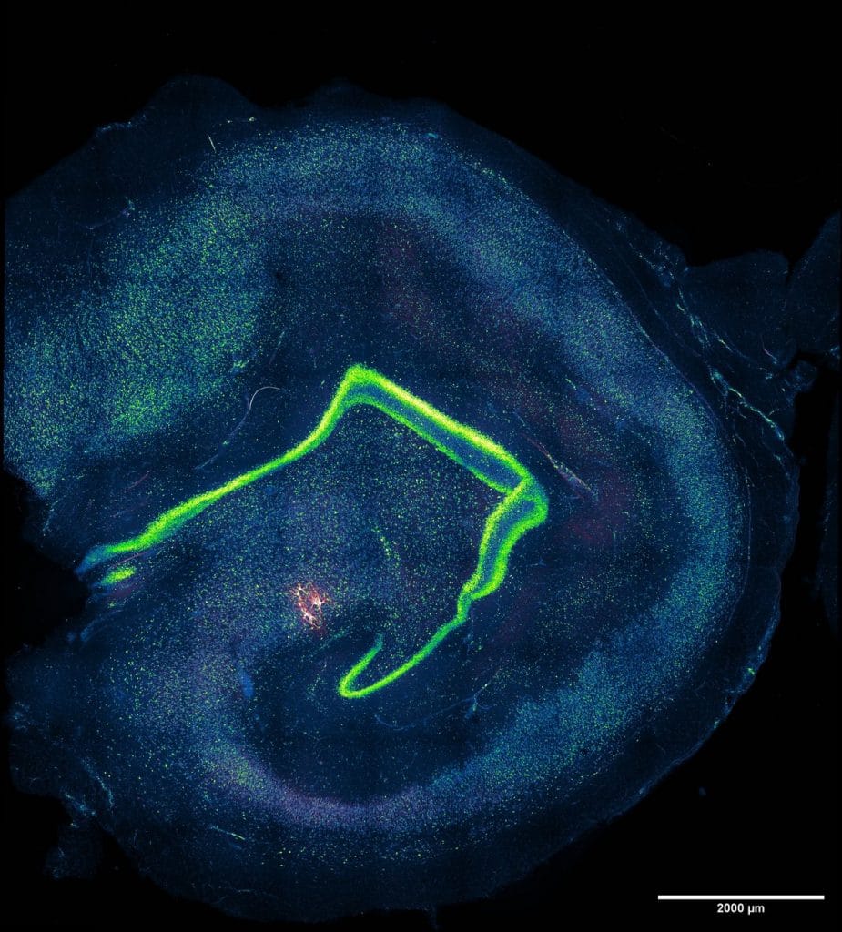 CA3 neurons (red) recorded from a slice of human hippocampal tissue. This region helps link time, place and emotion to form memories | Image courtesy ISTA