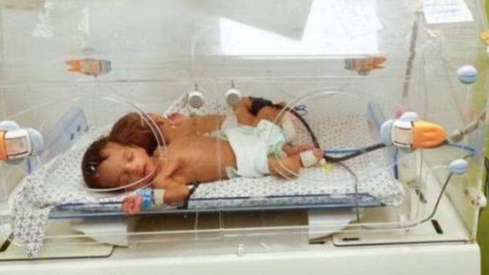 Preterm babies, also called preemies, typically weigh less than 2.5 kg at birth | Representative image | Reuters