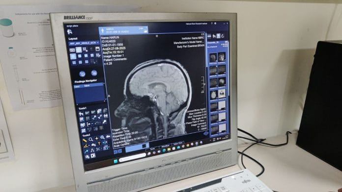 A sample structural MRI image of a brain