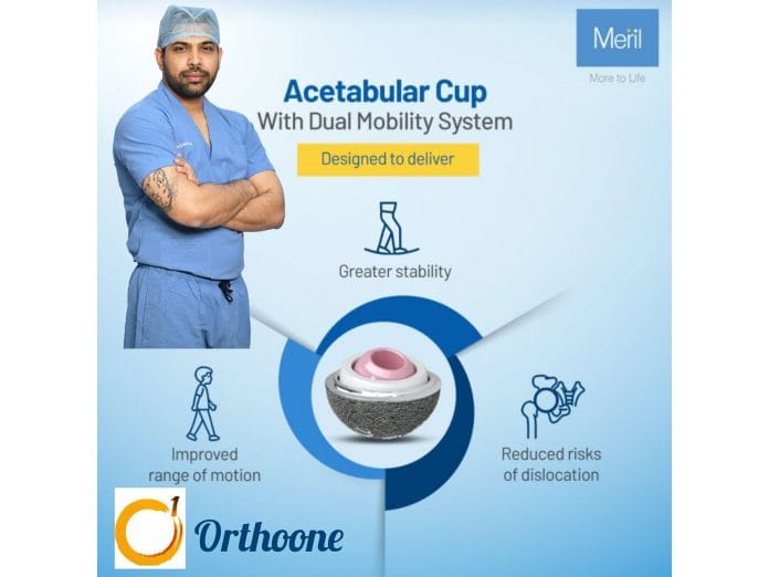 Modern Hip Replacement: Greater Stability and Longer Life with Dual Mobility and Ceramic Technology by Dr. Dibya Singha Das