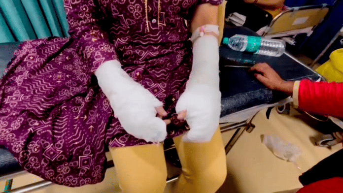 The DU student, being treated at a hospital for burn injuries, after the acid attack | PTI
