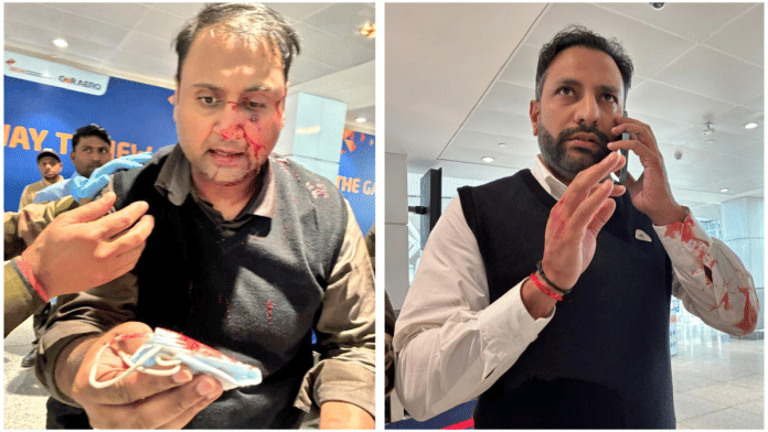 Ankit Dewan posted on his X account pictures of himself (left) and Air India Express pilot Capt. Virender Sejwal (right), who he claimed assaulted him at Delhi airport