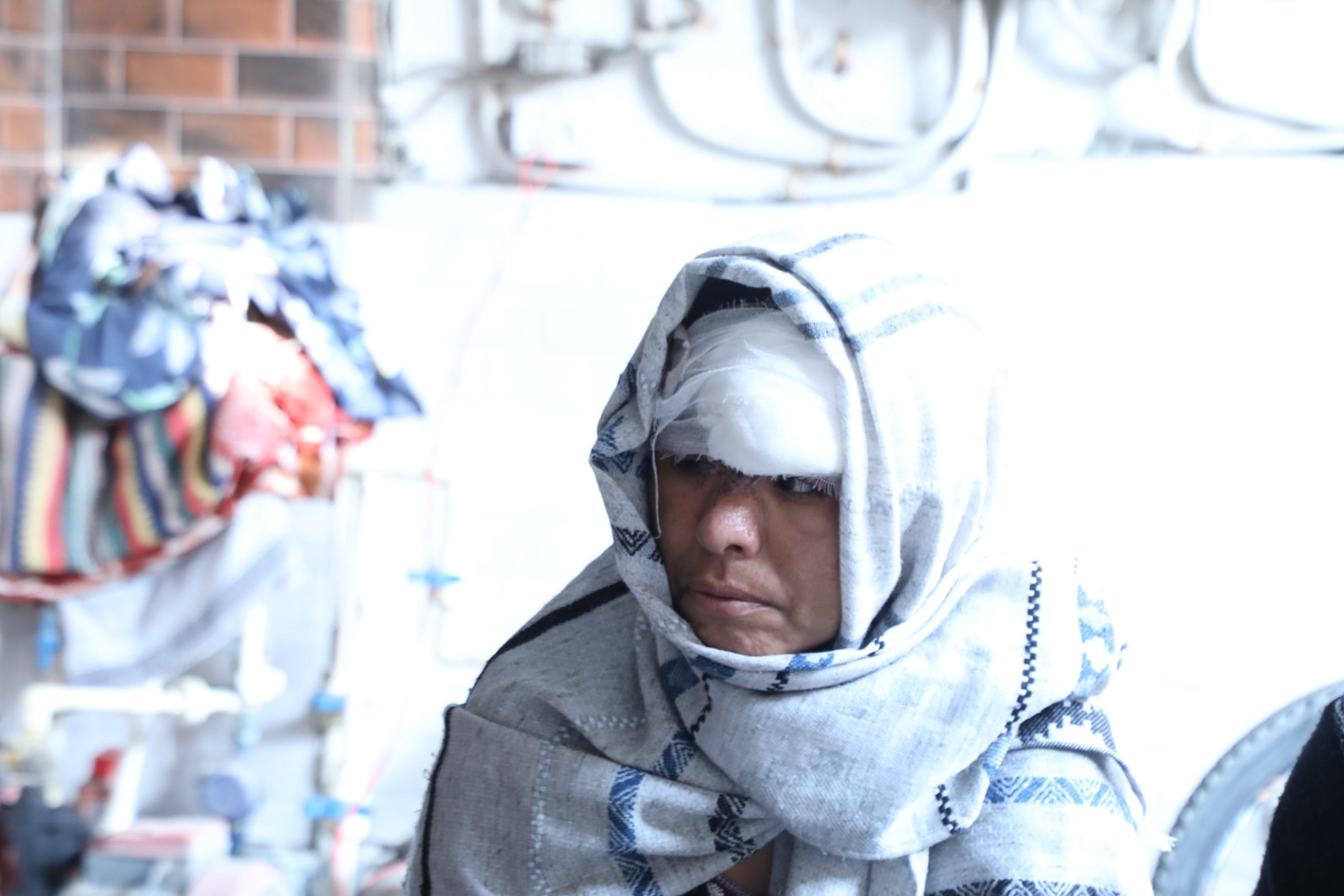 नवंबर में भालू के हमले में घायल हुई लक्ष्मी देवी. उनका चेहरा बुरी तरह जख्मी हो गया और अब उनकी नज़र पर असर पड़ा है | फोटो: सौम्या पिल्लई/दिप्रिंट