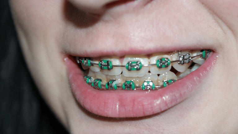 Our ancestors never needed dental braces. Here is why