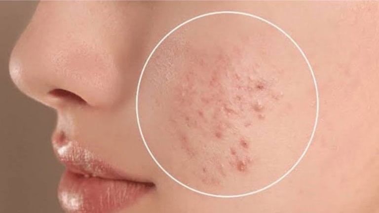 That one skincare science rule most people get wrong—pH