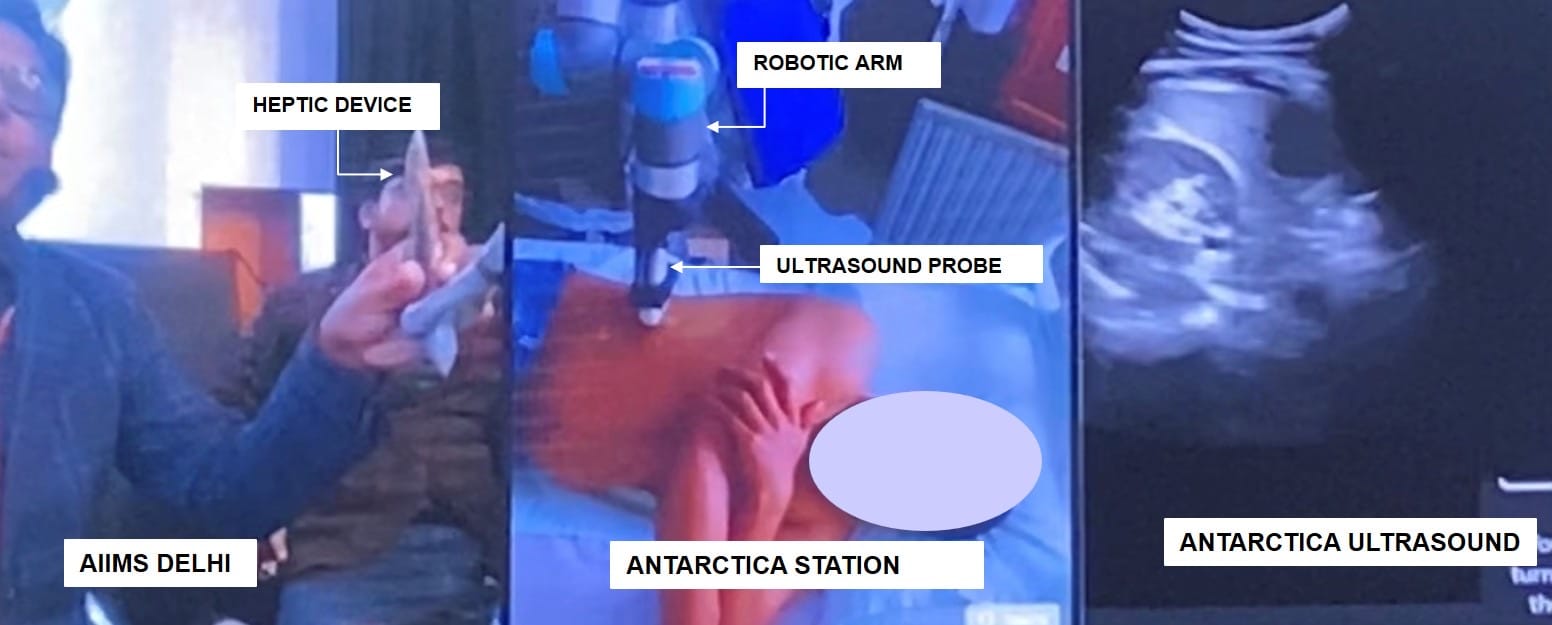 Ultrasound scans being relayed to doctors at AIIMS, Delhi | By special arrangement