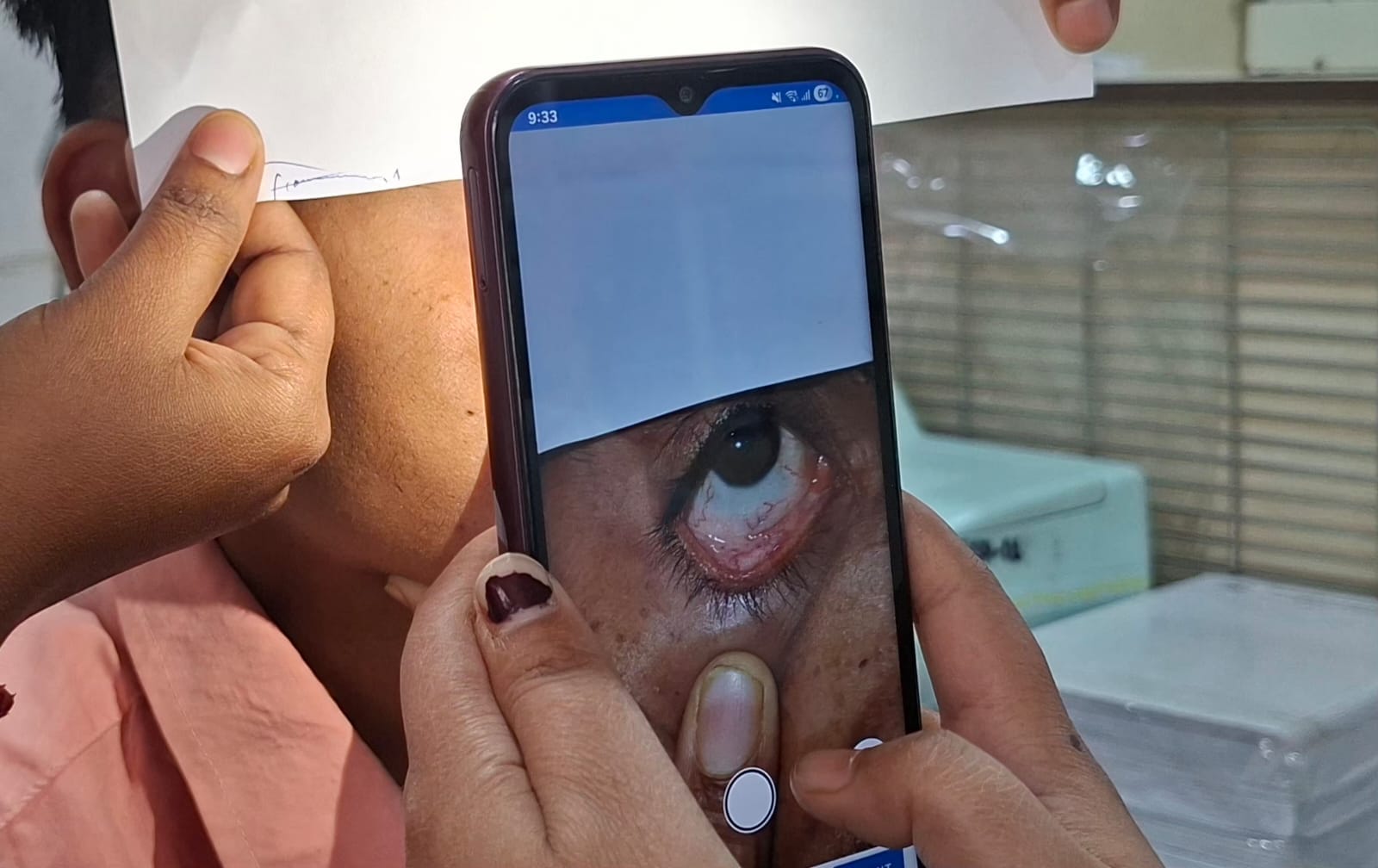 एक शोधकर्ता स्मार्टफोन से मरीज की निचली पलक की फोटो लेता है. इस तस्वीर को खून की जांच रिपोर्ट के साथ जोड़कर मशीन लर्निंग मॉडल में डाला जाता है, जिसे एनीमिया पहचानना सिखाया जा रहा है | इमेज: स्पेशल अरेंजमेंट