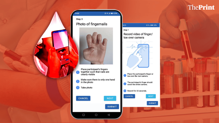 In a small town in Gujarat, researchers are training AI to detect anaemia, without drawing blood