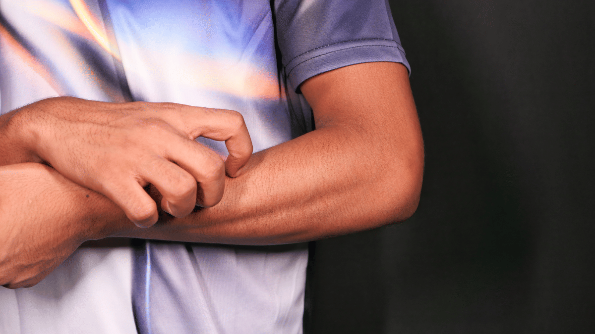 How to protect your skin from brutal summer heat rash