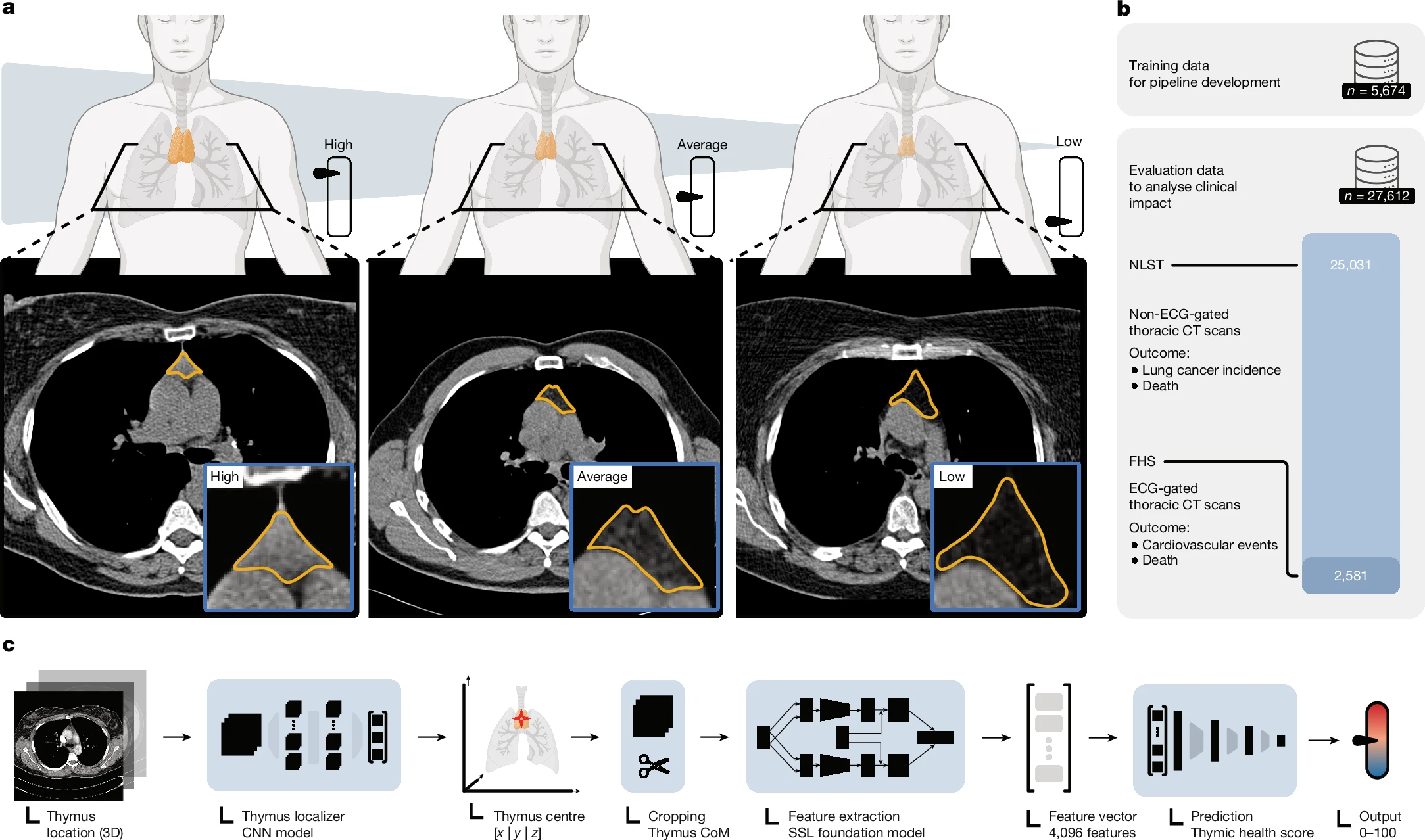 An illustration of thymic health, and three representative examples of individuals with high, average or low thymic health | Source: Nature study