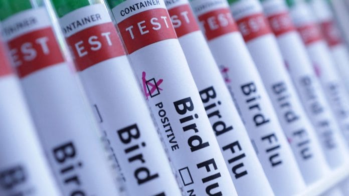 Test tubes are seen labelled 