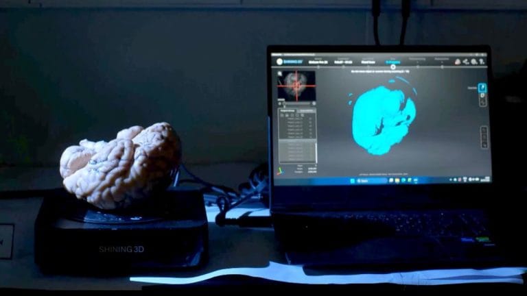 A Google Maps for the brain? IIT Madras releases detailed 3D atlas of human brainstem