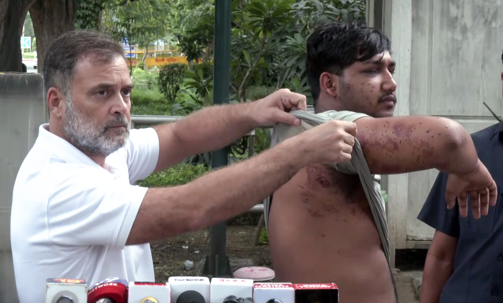 Lok Sabha LoP Rahul Gandhi brings before the media a man he claims suffered pellet gun injuries during the students' protest, in New Delhi on Friday | ANI Video Grab