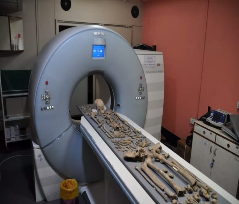 Skeletal remains from Rakhigarhi undergo CT scanning as part of scientific analysis | Photo by special arrangement